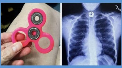 8 brinquedos populares que podem machucar seu filho 1