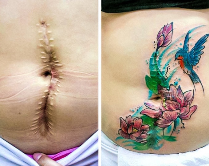 21 tatuagens que transformam cicatrizes em obras de arte 11