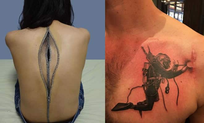 21 tatuagens que transformam cicatrizes em obras de arte