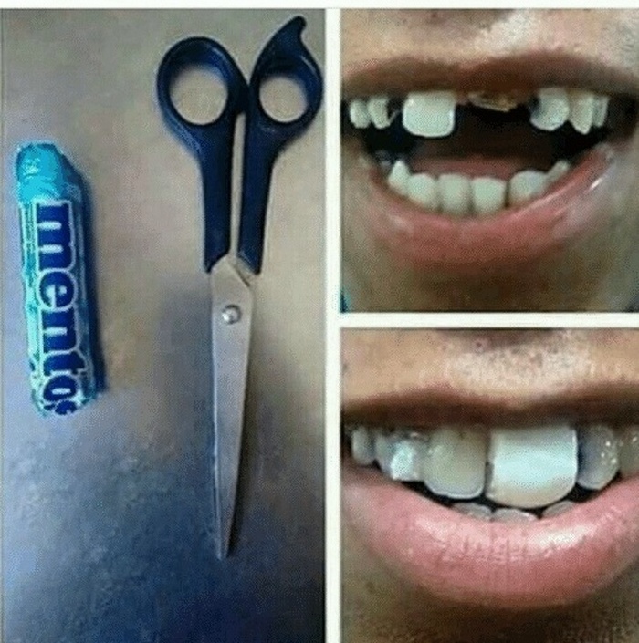 Sem dinheiro para um dentista