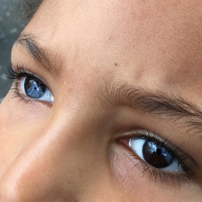 Você já viu uma pessoa cujos olhos são azuis e marrons ao mesmo tempo?