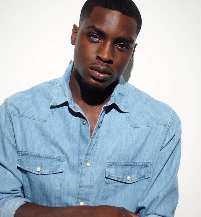 Homem com heterocromia – condição em que a íris de um olho é diferente do outro