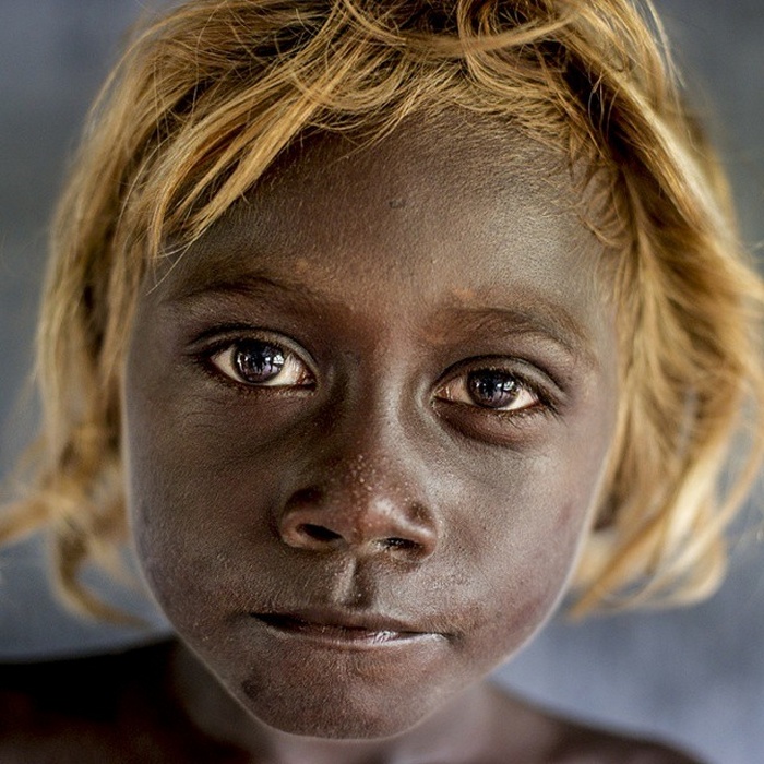 Habitantes negros das Ilhas Salomão desenvolveram um gene que os deixa com cabelos loiros