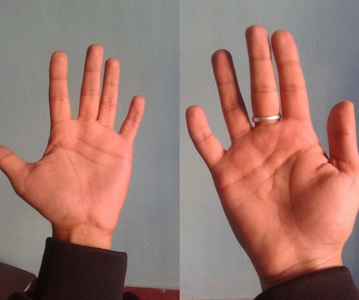 Dedo mindinho diferente