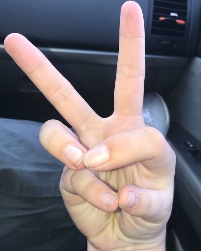 O que há de errado com essa foto?