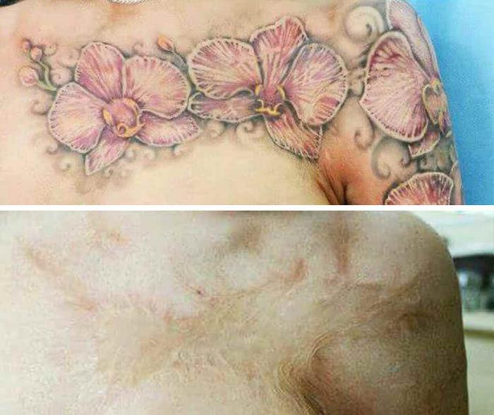 20 fantásticas tatuagens que fazem marcas de nascença e cicatrizes ficarem vivas 3