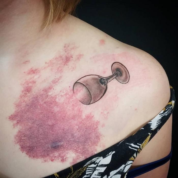 20 fantásticas tatuagens que fazem marcas de nascença e cicatrizes ficarem vivas 14