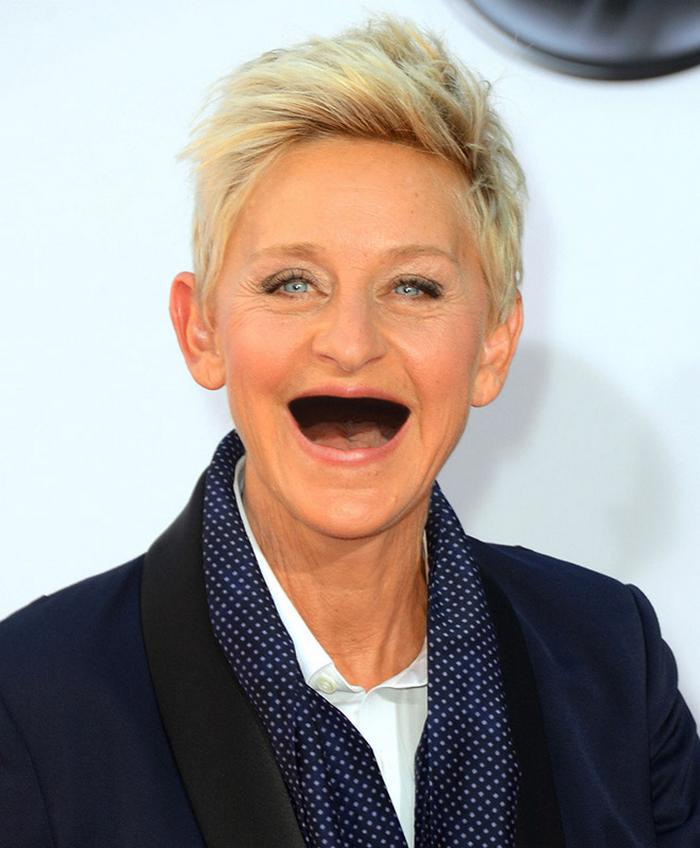 20 celebridades sem dentes 4