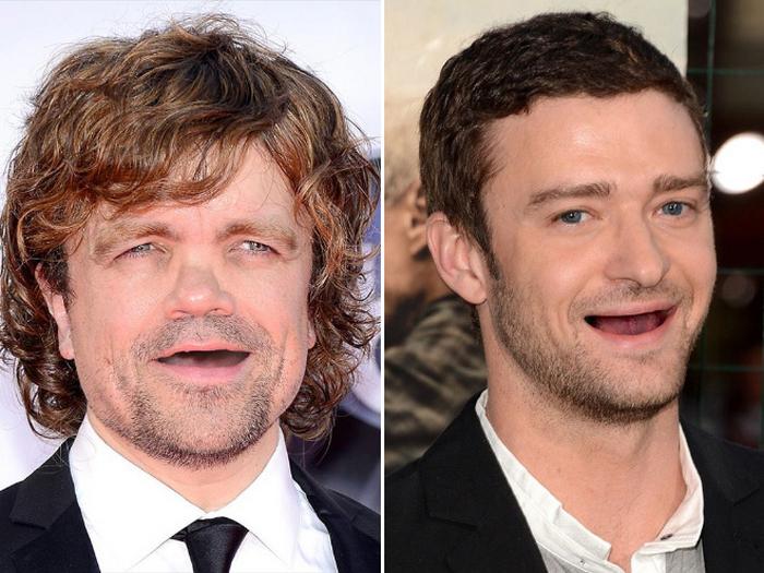 20 celebridades sem dentes 10