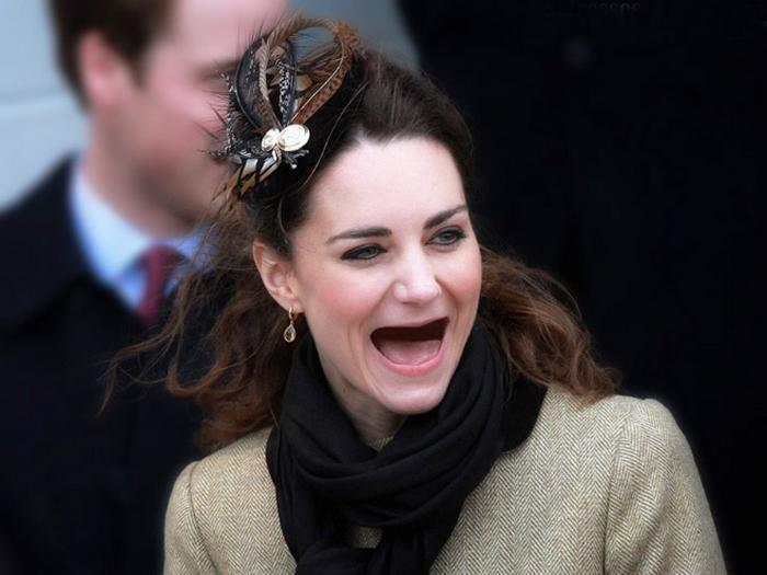 20 celebridades sem dentes 11