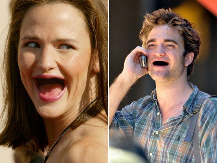 20 celebridades sem dentes 18