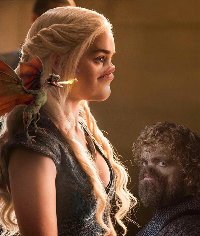 22 celebridades sem nariz 3