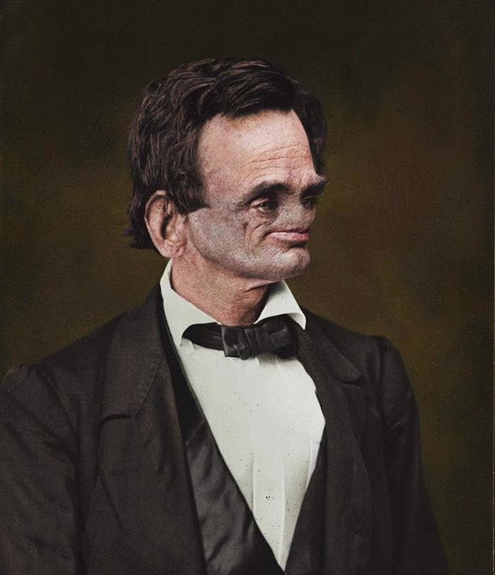 22 celebridades sem nariz 10