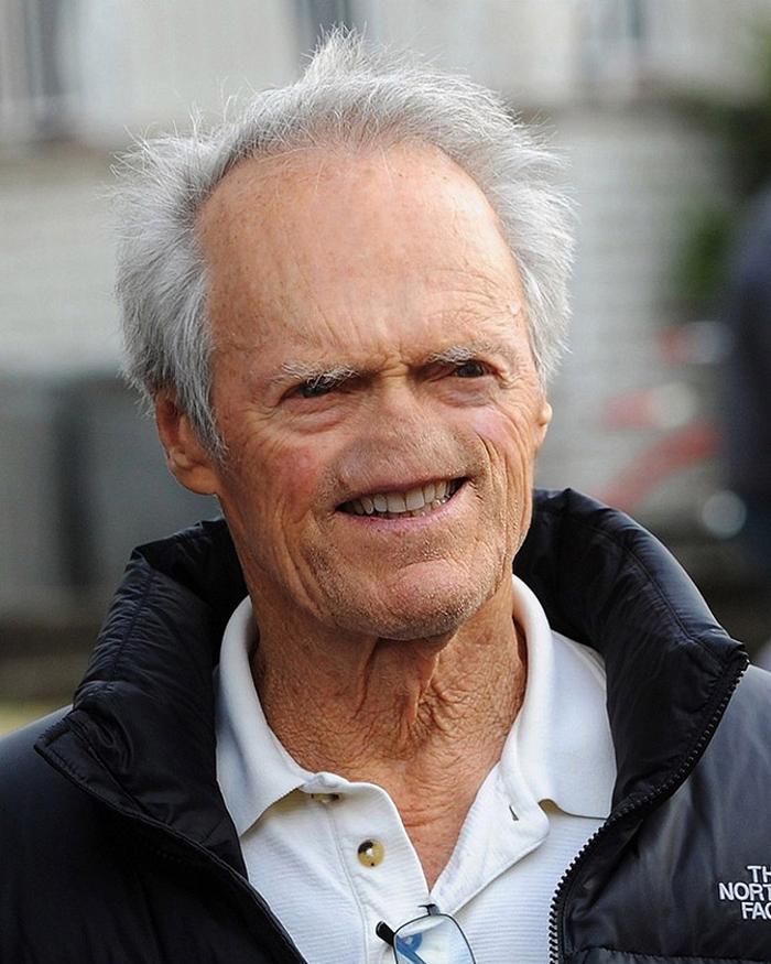 22 celebridades sem nariz 14