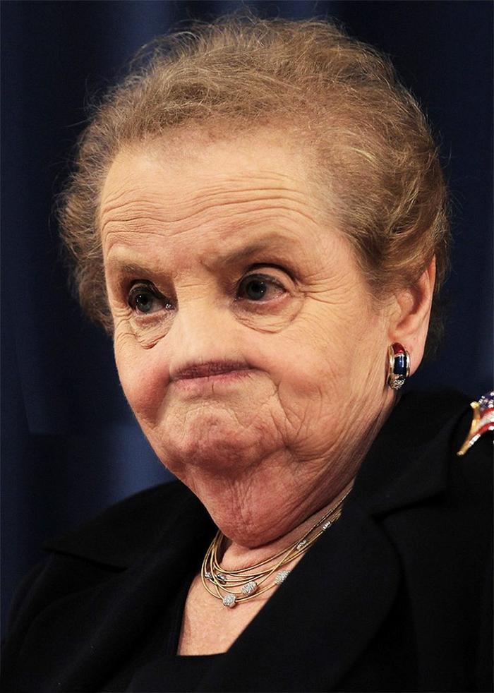 22 celebridades sem nariz 17