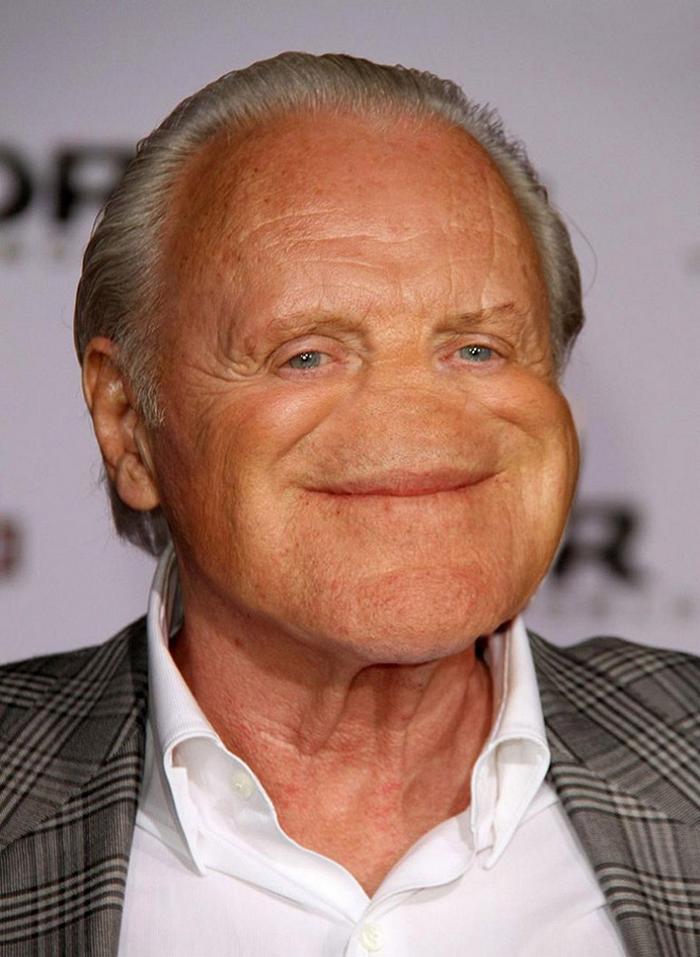 22 celebridades sem nariz 20