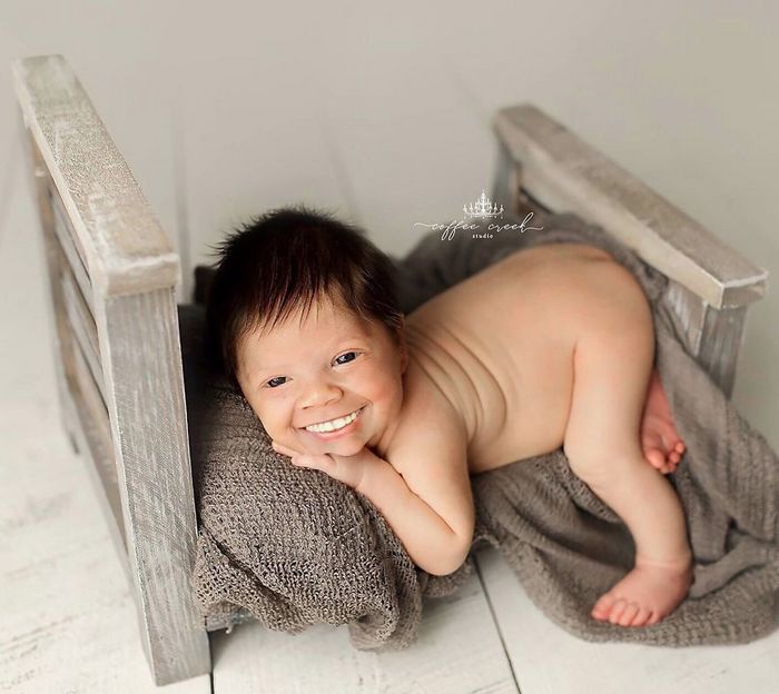 E se os bebês nascessem com dentes? (16 fotos) 5