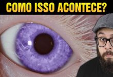 O raro caso dos olhos violeta, como isso acontece? 10