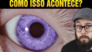 O raro caso dos olhos violeta, como isso acontece? 8