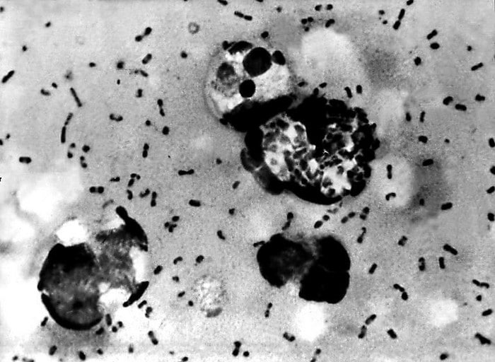 12 pandemias pelas quais a humanidade passou 10