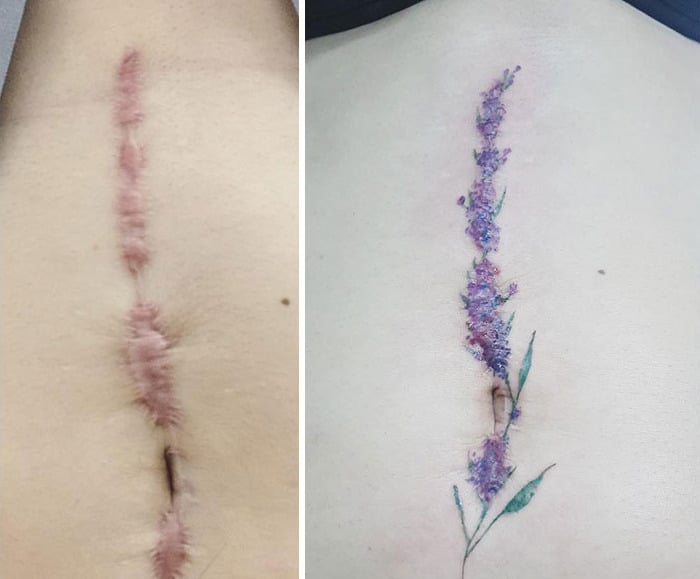 30 pessoas que pediram para encobrir suas cicatrizes com tatuagem 4