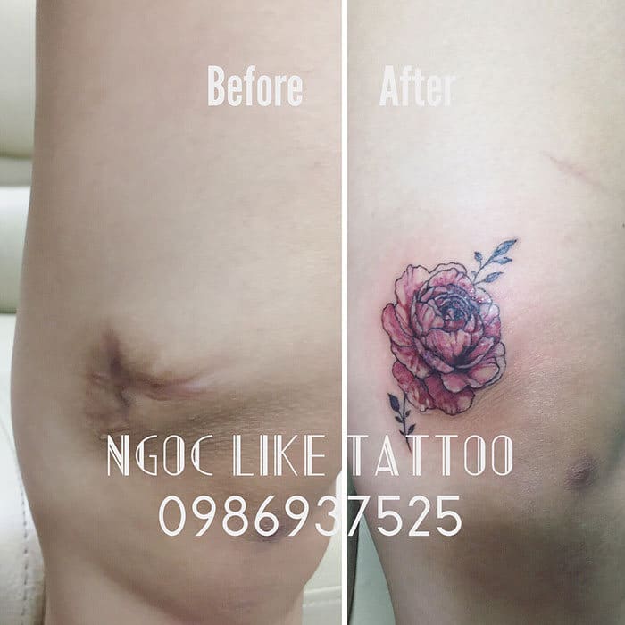 30 pessoas que pediram para encobrir suas cicatrizes com tatuagem 9