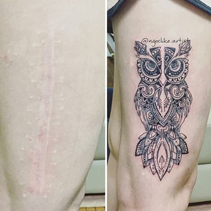 30 pessoas que pediram para encobrir suas cicatrizes com tatuagem 16