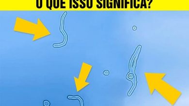 5 coisas que muitas pessoas tem mas não sabem o significado 9