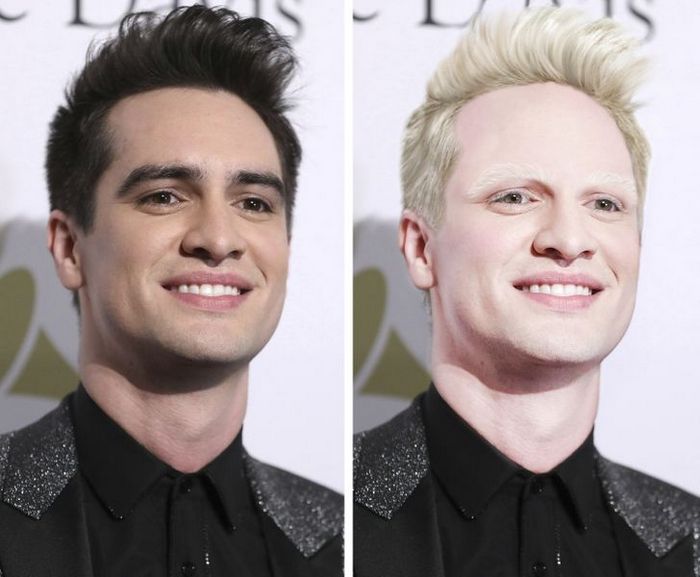 Como seriam 15 celebridades se fossem albinos 11