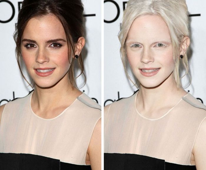 Como seriam 15 celebridades se fossem albinos 13