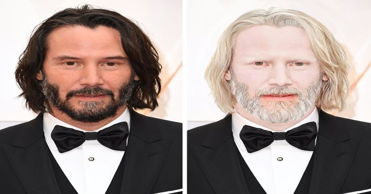 Como seriam 15 celebridades se fossem albinos