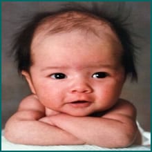 10 famosas que deixaram todos de queijo caído após adultas