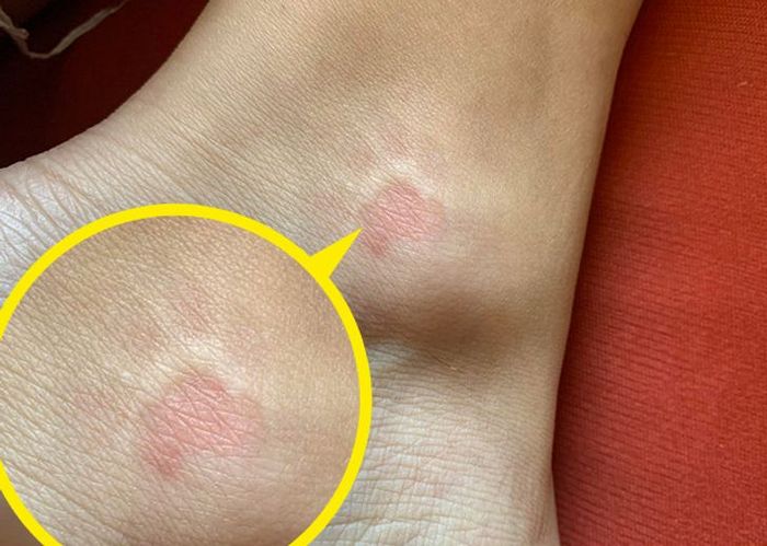 21 animais com características ou comportamentos que vai deixar você de boca aberta 21