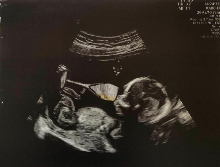 Comecei a enviar essas fotos para minha namorada sempre que ela perguntava se o bebê estava bem (42 fotos) 8