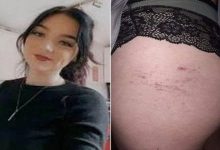 Mulher afirma que foi agredida por fantasma enquanto era vigiada tomando banho 7