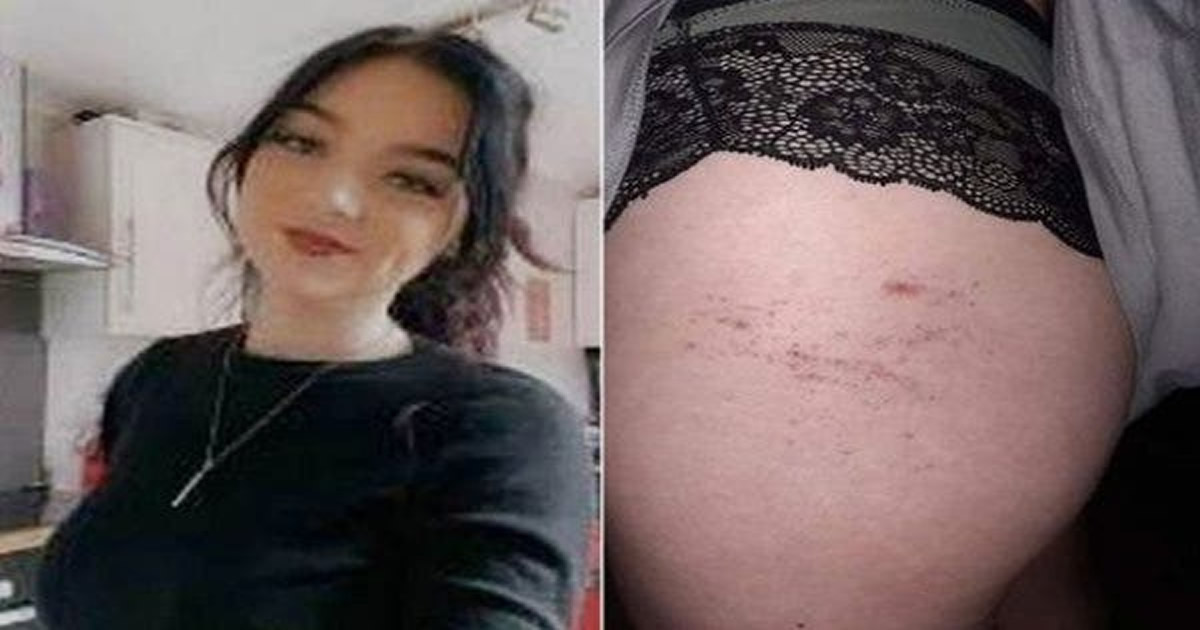 Mulher afirma que foi agredida por fantasma enquanto era vigiada tomando banho