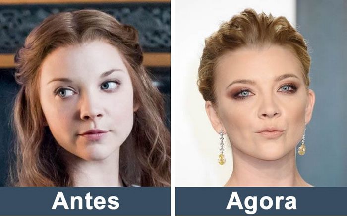 Como estão os atores de Game of Thrones nos dias de hoje (14 fotos) 5