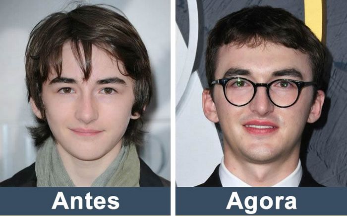 Como estão os atores de Game of Thrones nos dias de hoje (14 fotos) 7