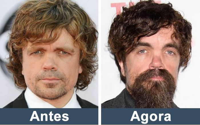 Como estão os atores de Game of Thrones nos dias de hoje (14 fotos) 8