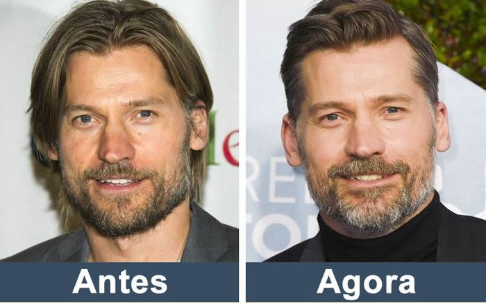 Como estão os atores de Game of Thrones nos dias de hoje (14 fotos) 12