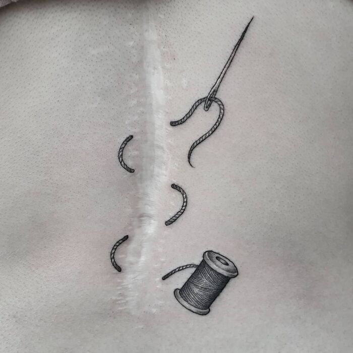 46 tatuagens incríveis que transformaram cicatrizes e marcas de nascença em obras de arte 13