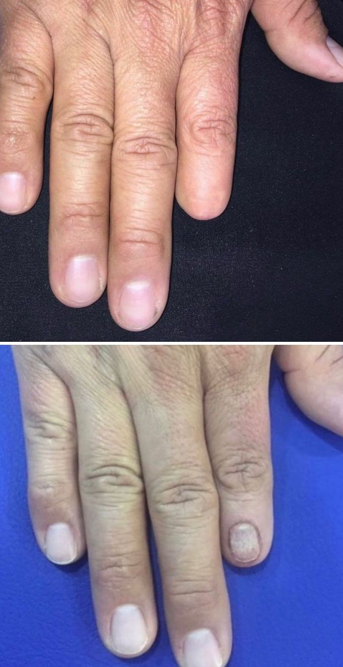 46 tatuagens incríveis que transformaram cicatrizes e marcas de nascença em obras de arte 30