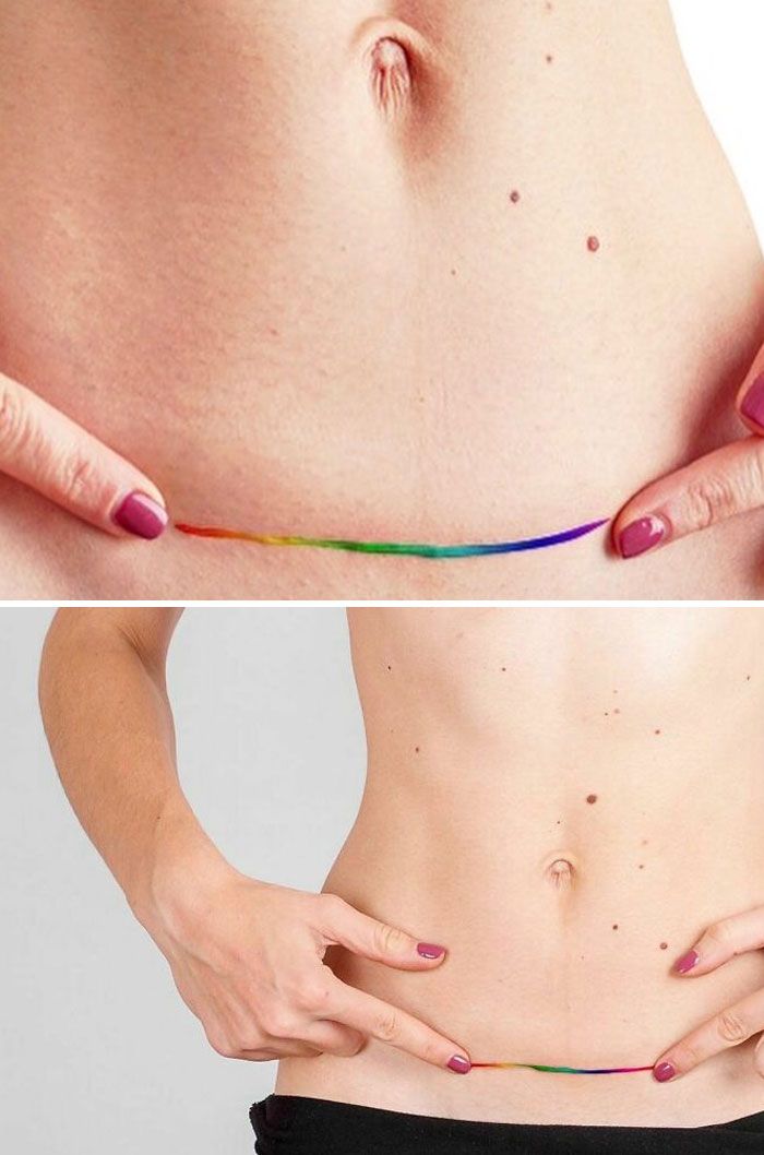 46 tatuagens incríveis que transformaram cicatrizes e marcas de nascença em obras de arte 36