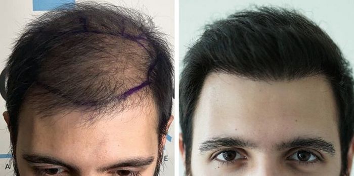 20 pessoas que deixaram o passado pra trás e mudaram suas vidas 8