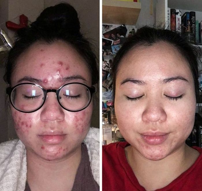 20 pessoas que deixaram o passado pra trás e mudaram suas vidas 18