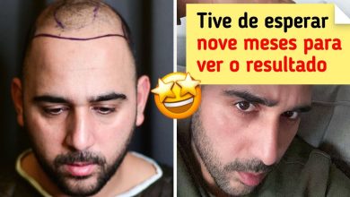 20 pessoas que deixaram o passado pra trás e mudaram suas vidas 4