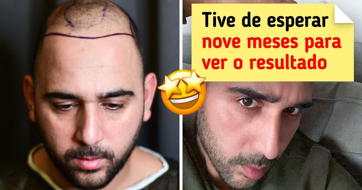 20 pessoas que deixaram o passado pra trás e mudaram suas vidas
