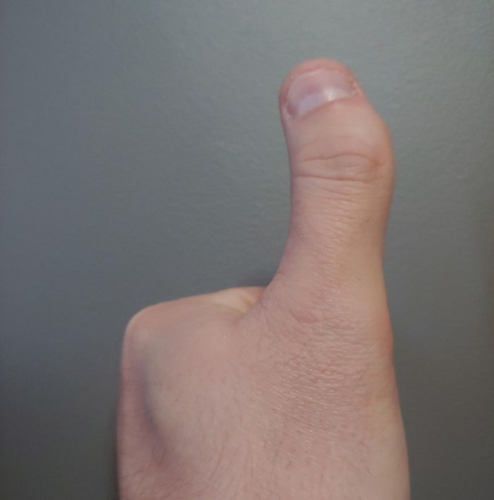 16 pessoas e animais únicos que nasceram para se destacar 8