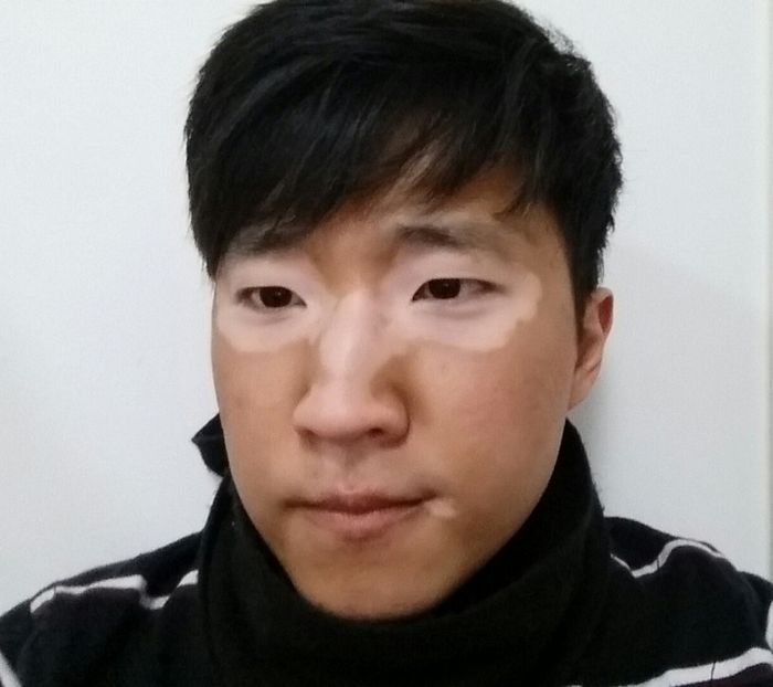 16 pessoas e animais únicos que nasceram para se destacar 14