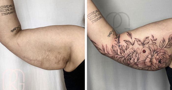 15 pessoas que recuperaram a confiança após transformar suas cicatrizes em tatuagem 1